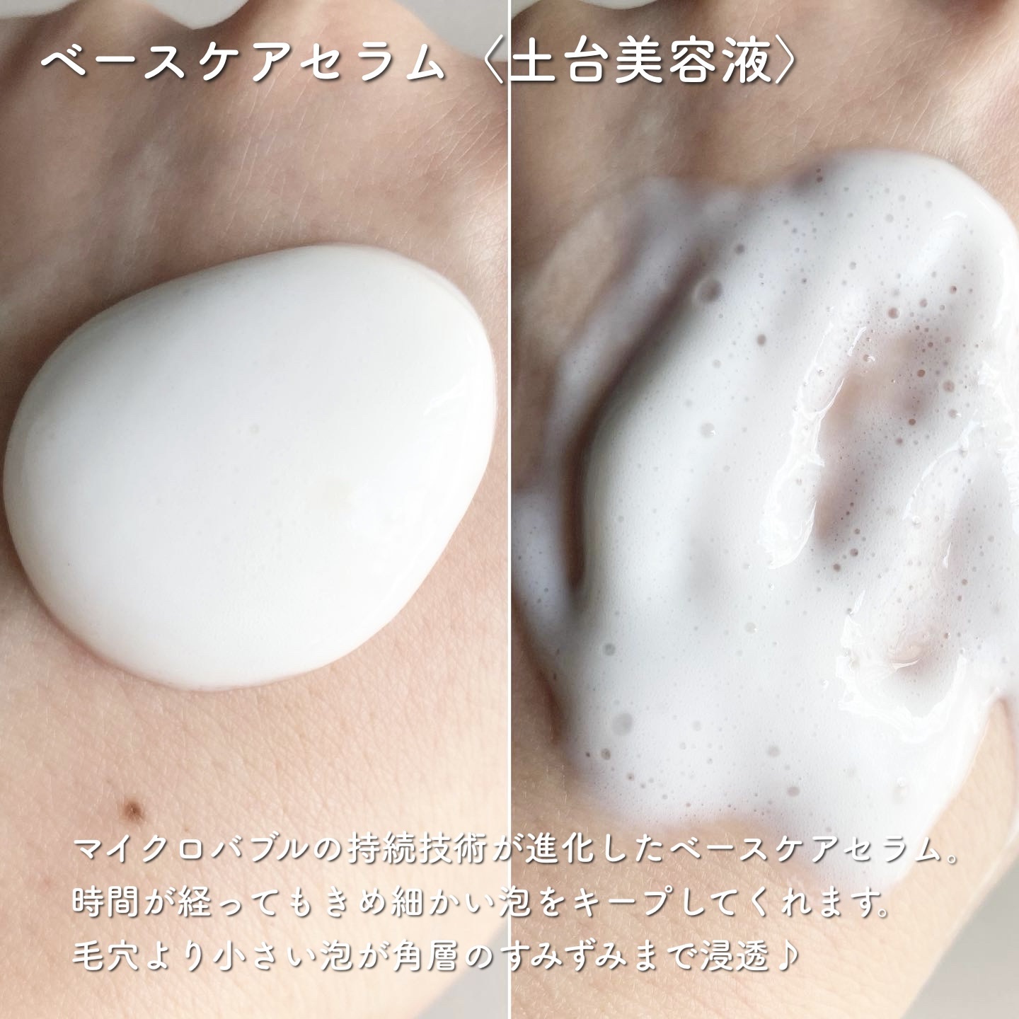 ソフィーナ iP 角層トリートメント 基礎化粧液/SOFINA iP/化粧水を使ったクチコミ（2枚目）