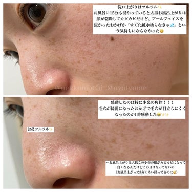 　どんぶらこ♡フォロバ100 on LIPS 「アールフェイスのプロモーションに参加中です▶︎アールフェイス　..」（4枚目）