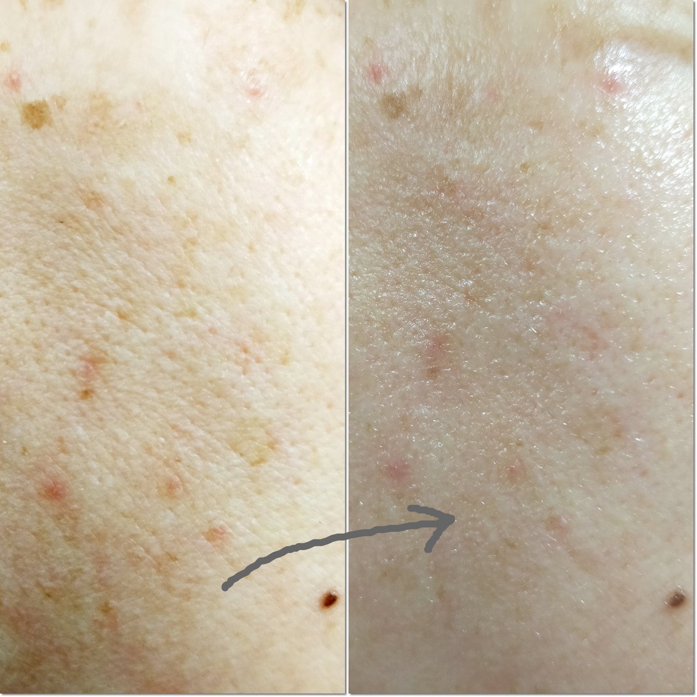 ドクタージー ピュア ビタミンA ファーミングマスク/Dr.G/シートマスク・パックを使ったクチコミ(5枚目)