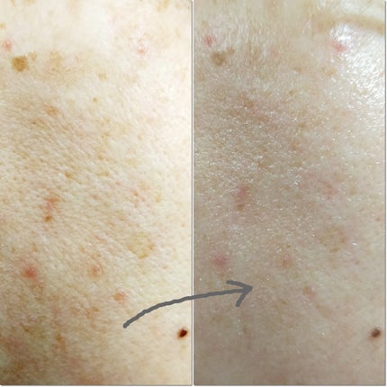 ドクタージー ピュア ビタミンA ファーミングマスク/Dr.G/シートマスク・パックを使ったクチコミ(5枚目)