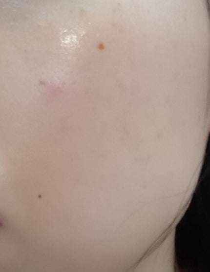 ホワイトアップ ローション(II)/アクアレーベル/化粧水を使ったクチコミ(2枚目)