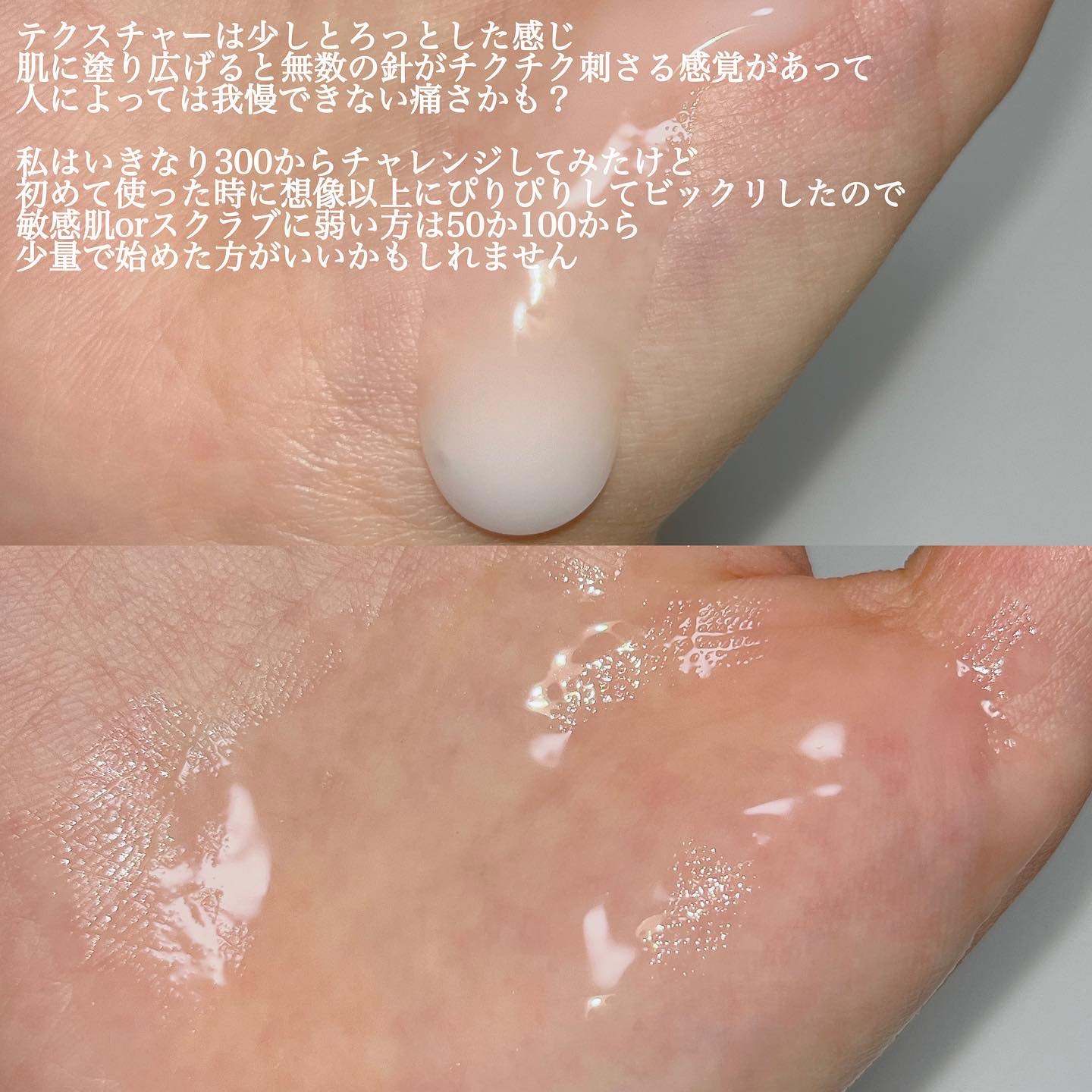 リードルショット300/VT/美容液を使ったクチコミ（3枚目）