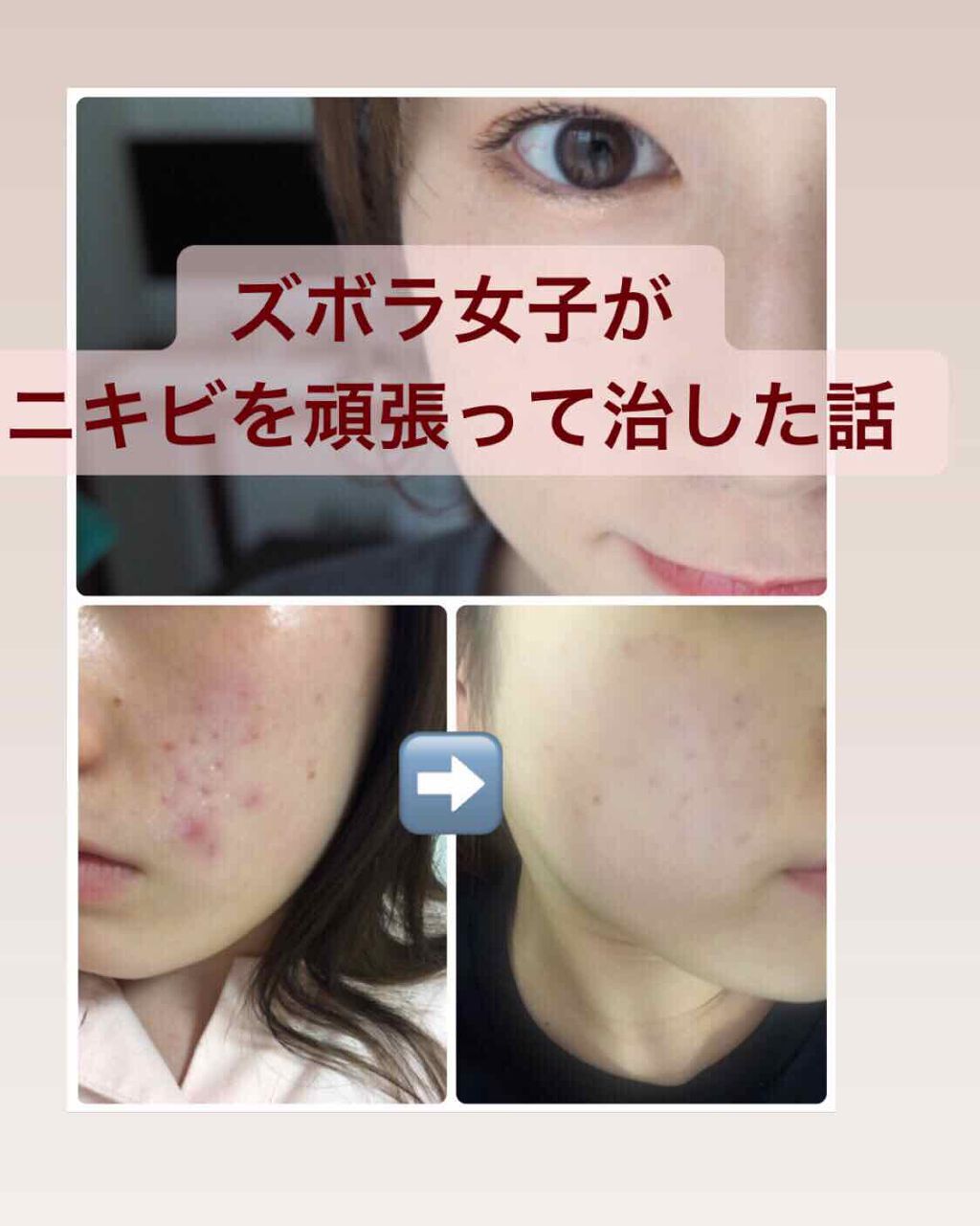 ブラン エクスペール クッションコンパクト L n/LANCOME/クッションファンデーションを使ったクチコミ（1枚目）