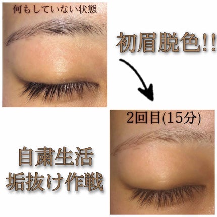 脱色クリーム 敏感肌用/エピラット/ムダ毛ケアを使ったクチコミ(1枚目)