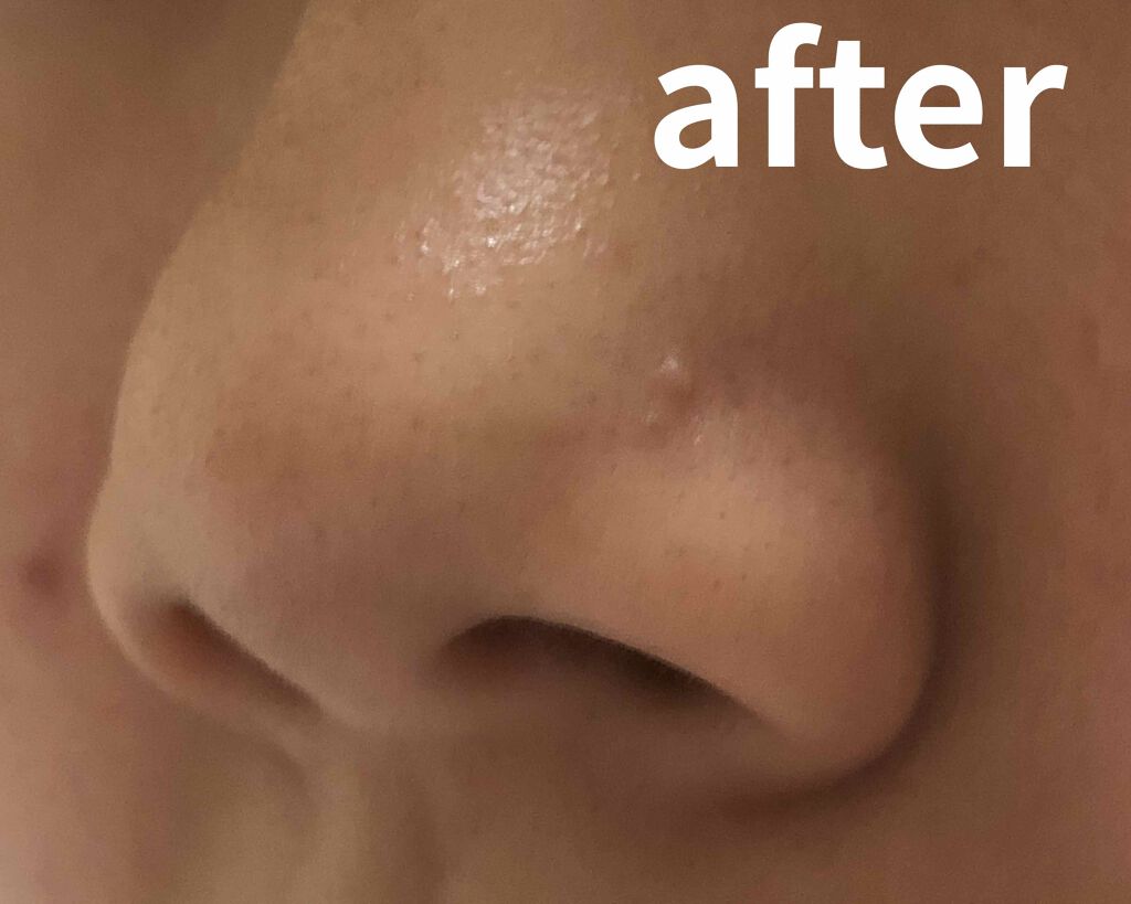 フェイスピーリングジェル ピーチの香り/DAISO/ピーリングを使ったクチコミ（2枚目）