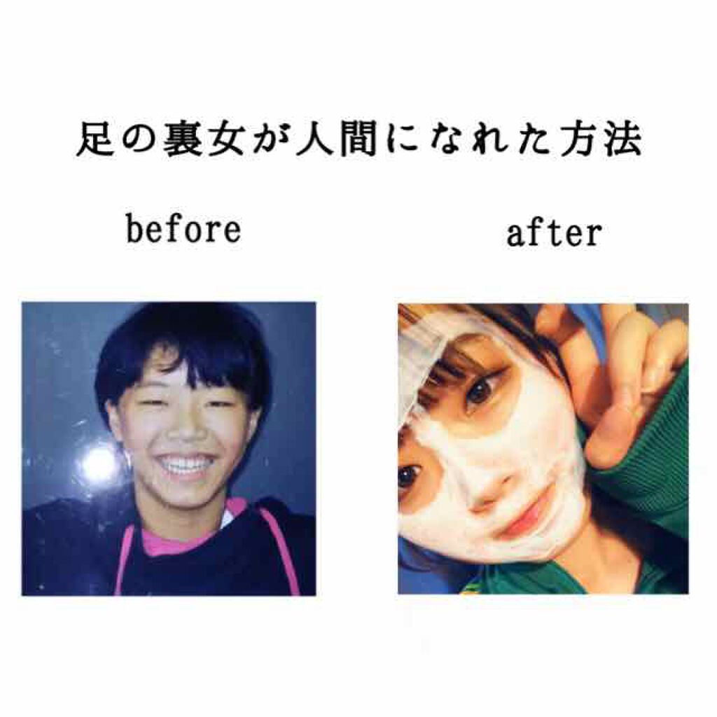 クリアアクネスポッツ/オルビス/美容液を使ったクチコミ（1枚目）