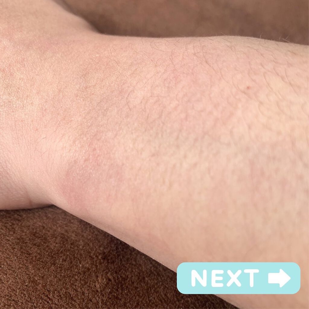 エピリムーバー N/TBC/除毛クリームを使ったクチコミ（3枚目）