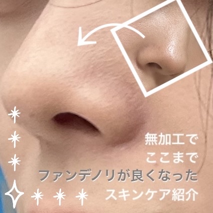 明色美顔水 薬用化粧水/美顔/化粧水を使ったクチコミ（1枚目）