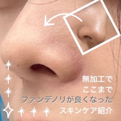 明色美顔水 薬用化粧水/美顔/化粧水を使ったクチコミ(1枚目)