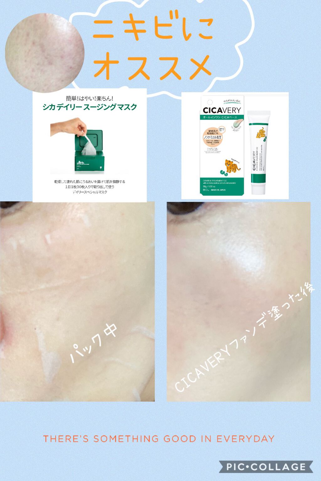 CICA デイリースージングマスク/VT/シートマスク・パックを使ったクチコミ(1枚目)