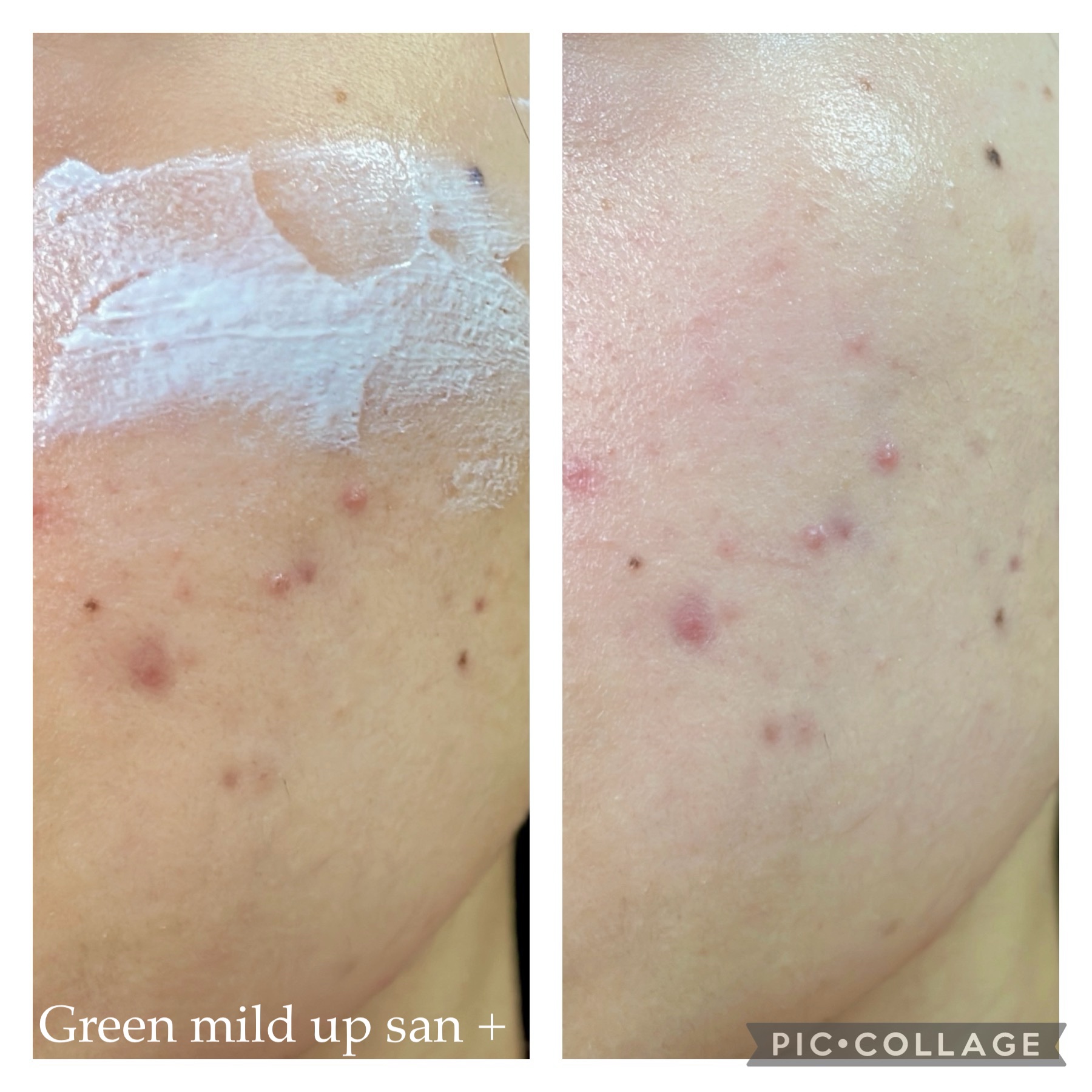 ブライトニングアップサンプラス/Dr.G/日焼け止めクリームを使ったクチコミ（3枚目）