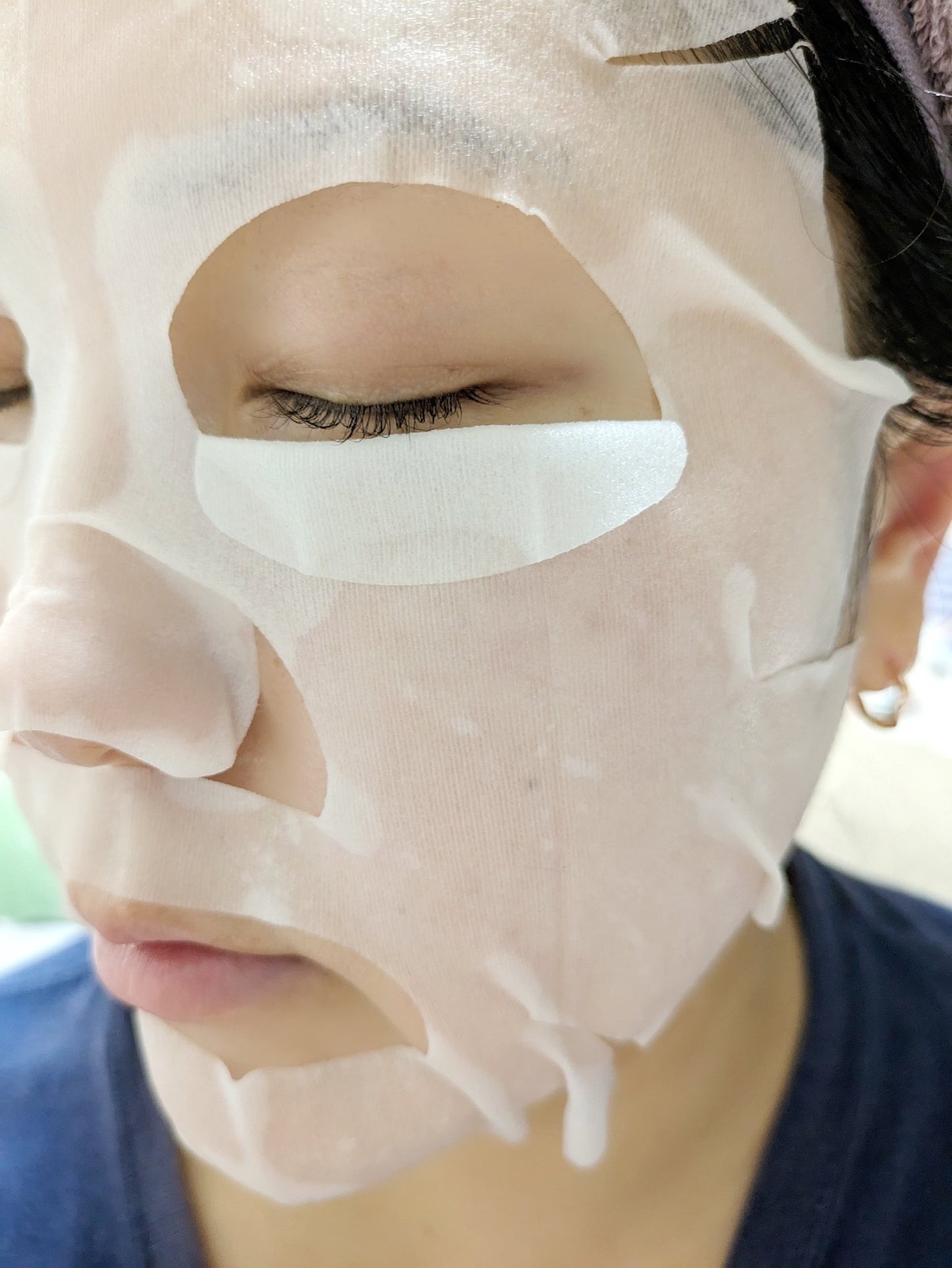 薬用ホワイトニング フェイシャルマスクEX/トランシーノ/シートマスク・パックを使ったクチコミ(2枚目)