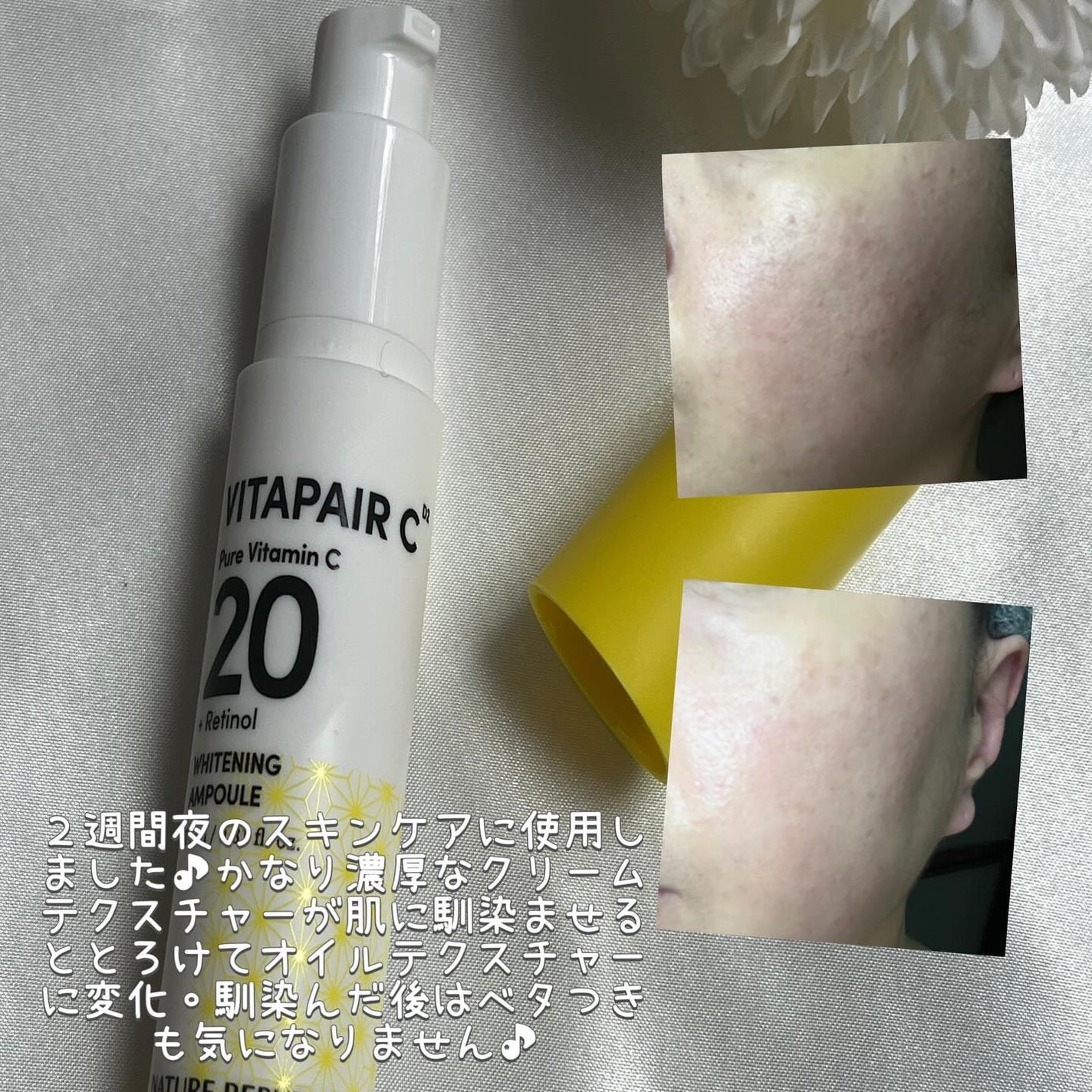 ビタペアC ビタレチ美容液/ネイチャーリパブリック/美容液を使ったクチコミ(4枚目)