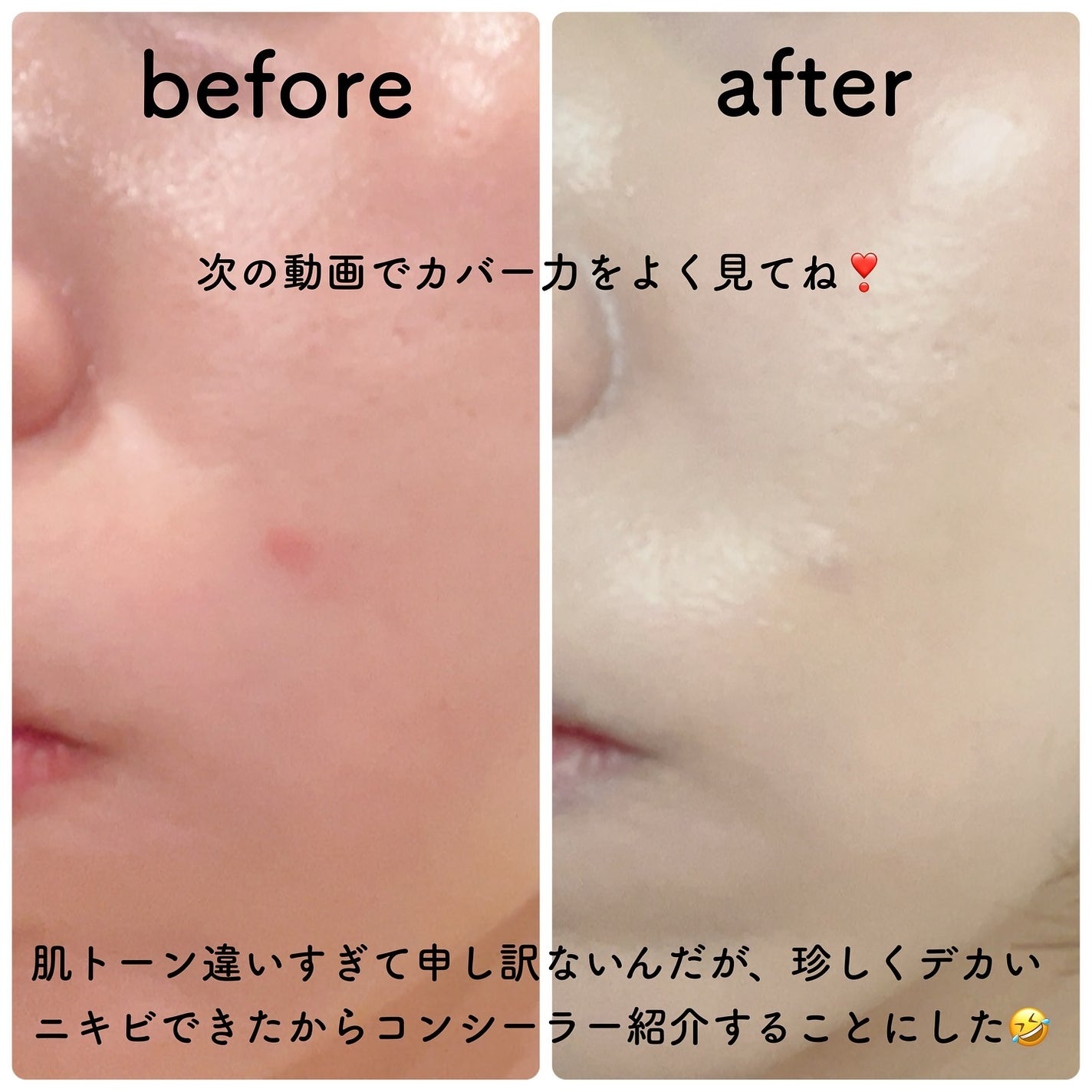 スポッツカバー ファウンデイション/SHISEIDO/クリームコンシーラーを使ったクチコミ(5枚目)