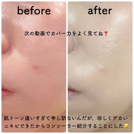 スポッツカバー ファウンデイション/SHISEIDO/クリームコンシーラーを使ったクチコミ(5枚目)