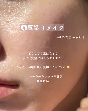 yuyu🐶肌荒れ体質の正直レビュー on LIPS 「【ニキビ跡ケア🔥やめてよかった6つのコト】✼••┈┈••✼••..」（5枚目）