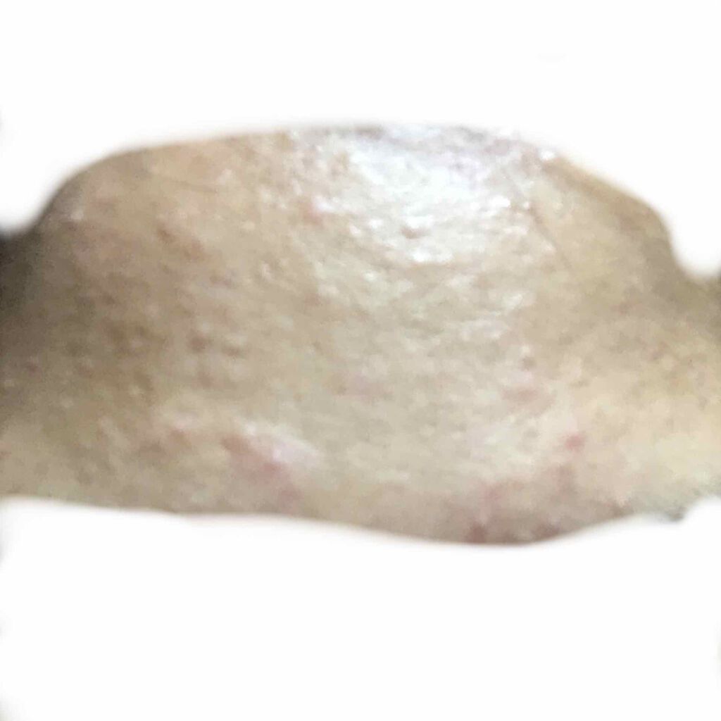 りず on LIPS 「こんにちは、はじめての投稿になります高校一年生女子、部活はテニ..」(1枚目)