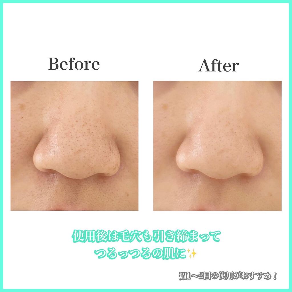 CICA ブラックヘッドクリーナー/VT/その他スキンケアを使ったクチコミ(4枚目)