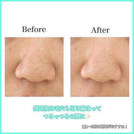 CICA ブラックヘッドクリーナー/VT/その他スキンケアを使ったクチコミ(4枚目)