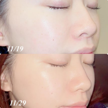 パンテノールバリアトナー/COSNORI/化粧水を使ったクチコミ(6枚目)