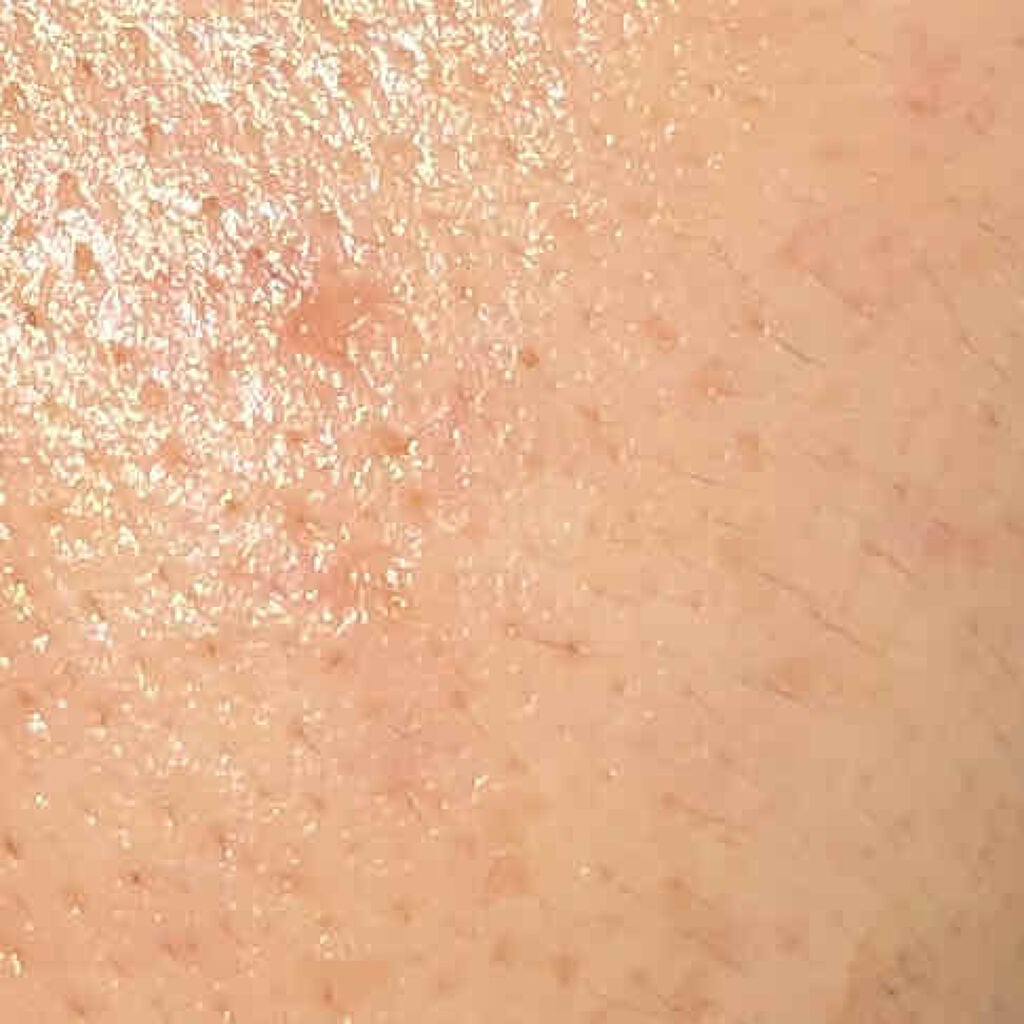 たぴこ【毎日投稿】 on LIPS 「〜12日目〜ご覧いただきありがとうございます😄私の肌のタイプは..」(2枚目)