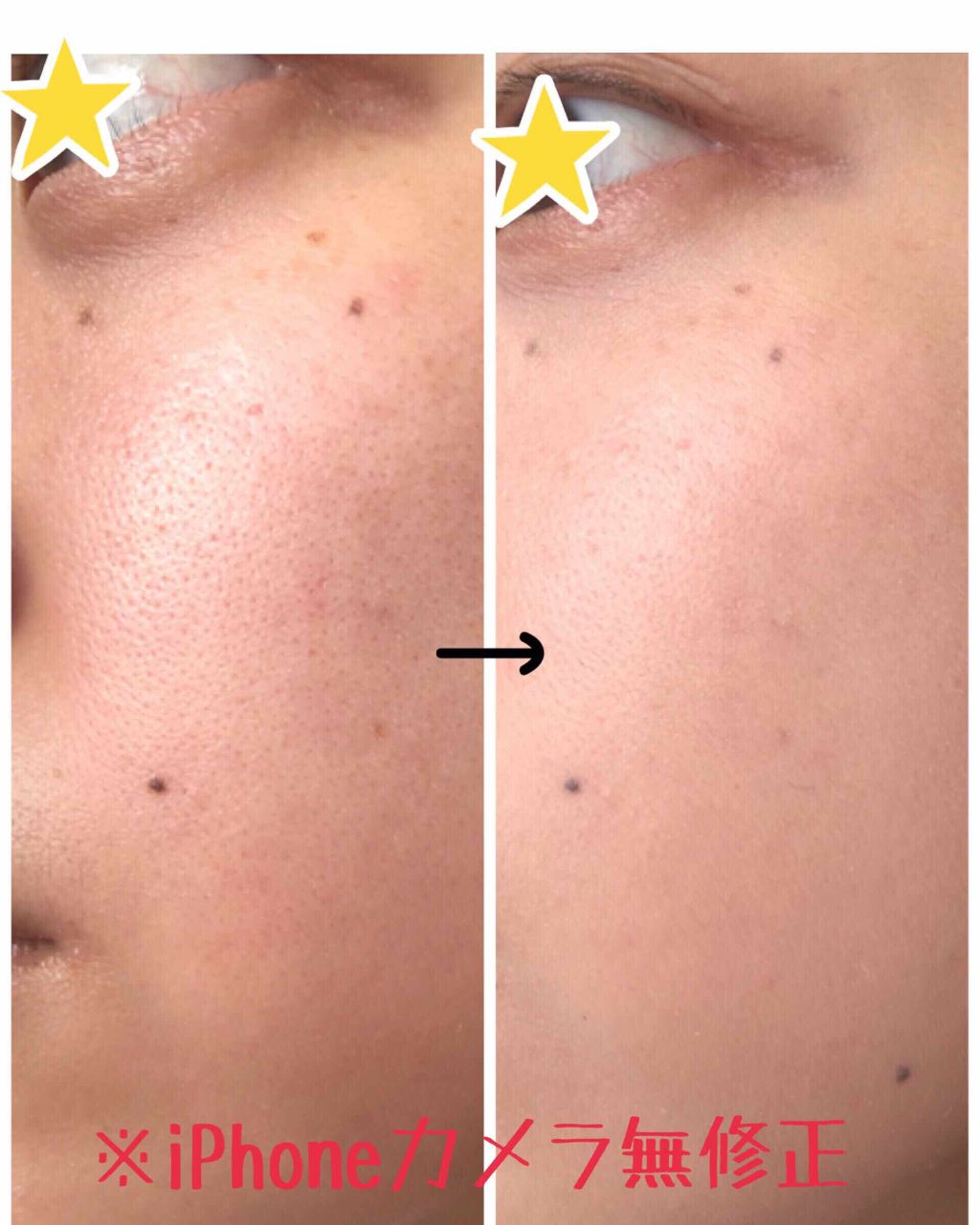 おしろい要らずのBBクリーム ナチュラル/レシピスト/BBクリームを使ったクチコミ（2枚目）