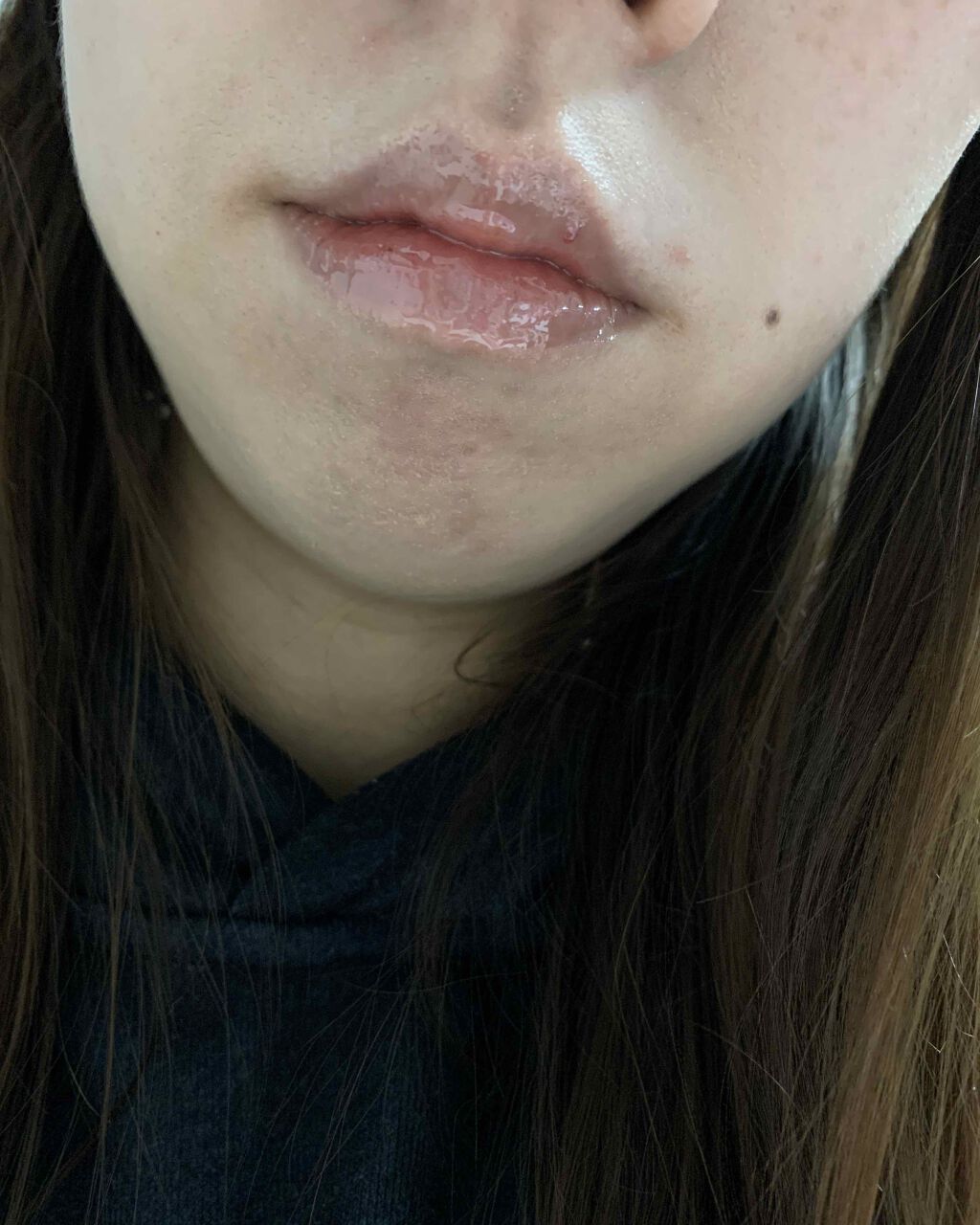 CHOOSY デイリップのクチコミ「チューシー☆デイリップ

⚠️唇の画像出ます

チューシーの唇美容液です😎
確かしまむらで買い.....」（3枚目）