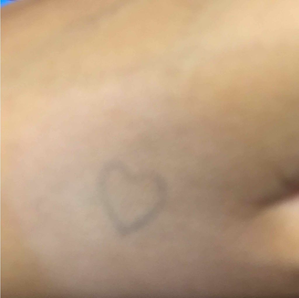 スティックコンシーラーA/KATE/スティックコンシーラーを使ったクチコミ(2枚目)