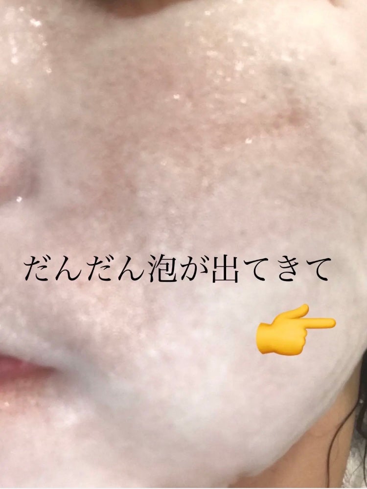 マジックバブルエッセンスパックMINI/BAKER7/シートマスク・パックを使ったクチコミ(3枚目)