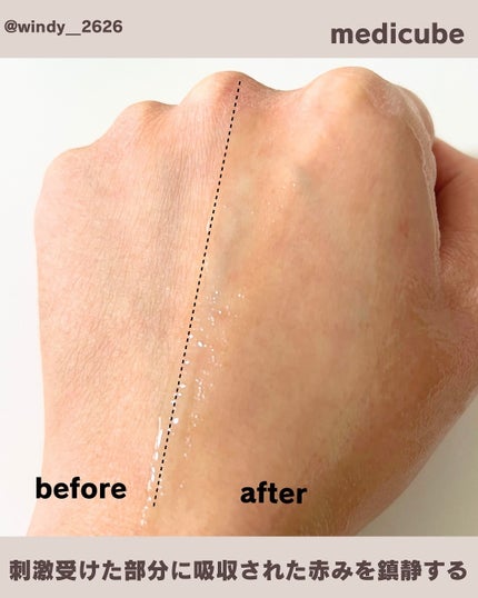 エクソソームシカセラム/MEDICUBE/美容液を使ったクチコミ(4枚目)