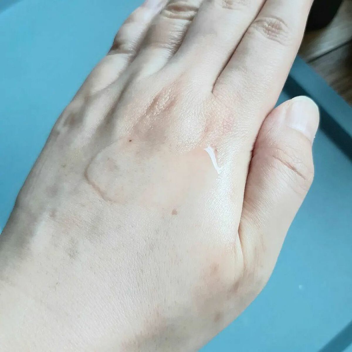 HITOKAN セラムローション/fracora/化粧水を使ったクチコミ（3枚目）