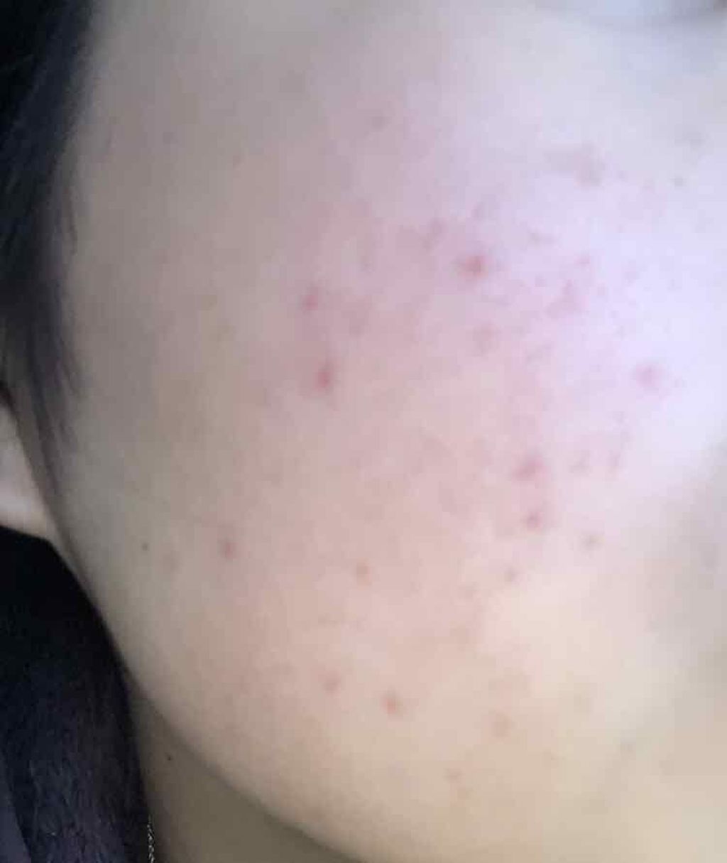 ハトムギ保湿ジェル(ナチュリエ スキンコンディショニングジェル)/ナチュリエ/美容液を使ったクチコミ（2枚目）