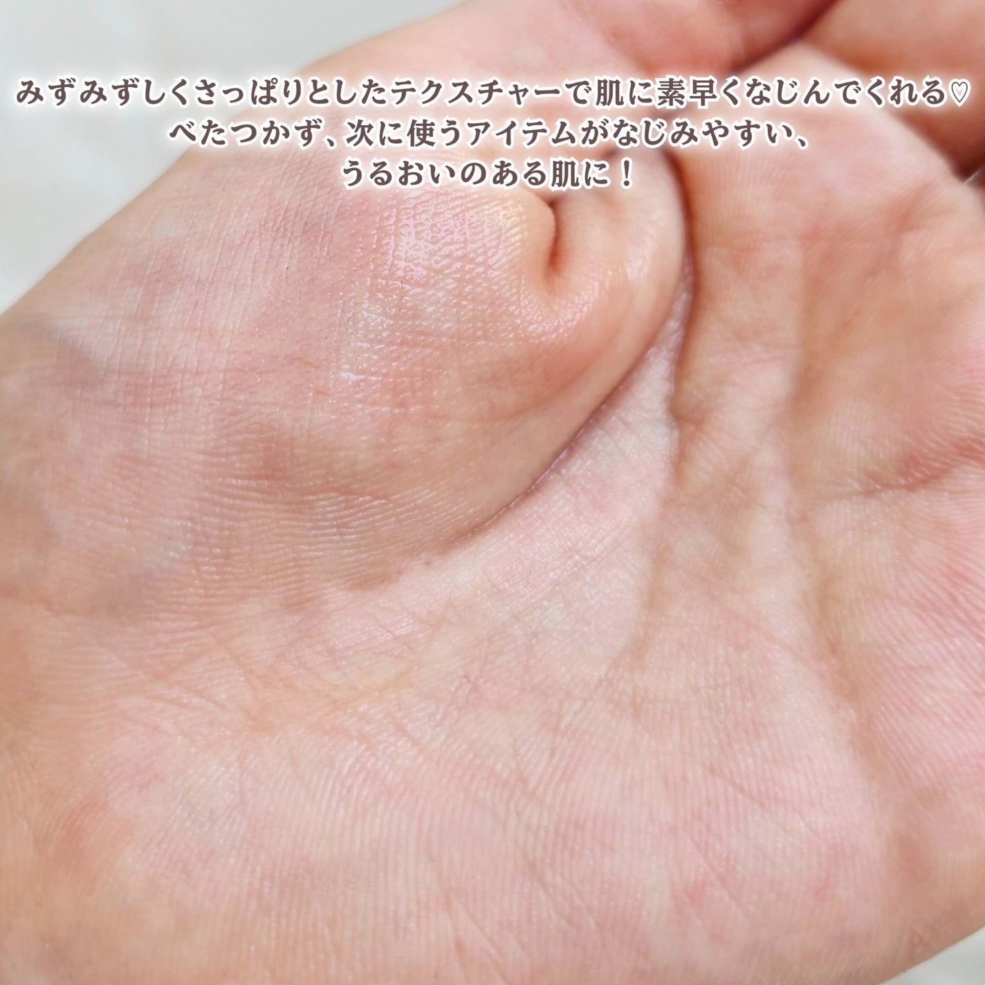 シミウス VCローション N/シミウス/化粧水を使ったクチコミ(3枚目)