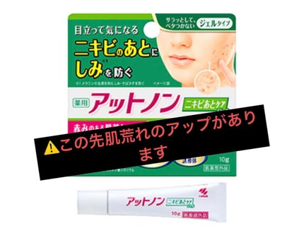 ニキビあとケアジェル/アットノン/その他スキンケアを使ったクチコミ(1枚目)