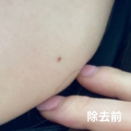 FILMOR/filmor/日焼け止め・UVケアを使ったクチコミ(2枚目)