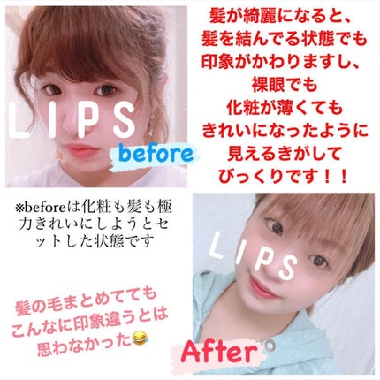 ð on LIPS ãâ€ïžããæ¯ãªã©ã§é«ªåã«æ©ãã§ã人ã¯ãçž®æ¯ç¯æ£ãããããããŸãâ€..ãïŒ4æç®ïŒ