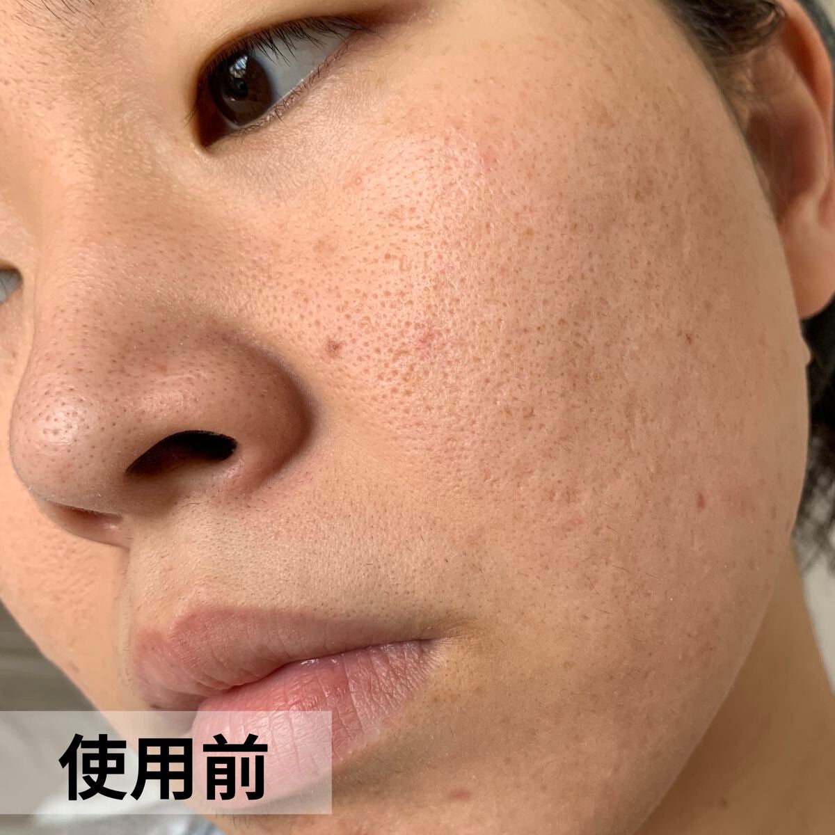 オバジC リファインローション /オバジ/化粧水を使ったクチコミ(6枚目)