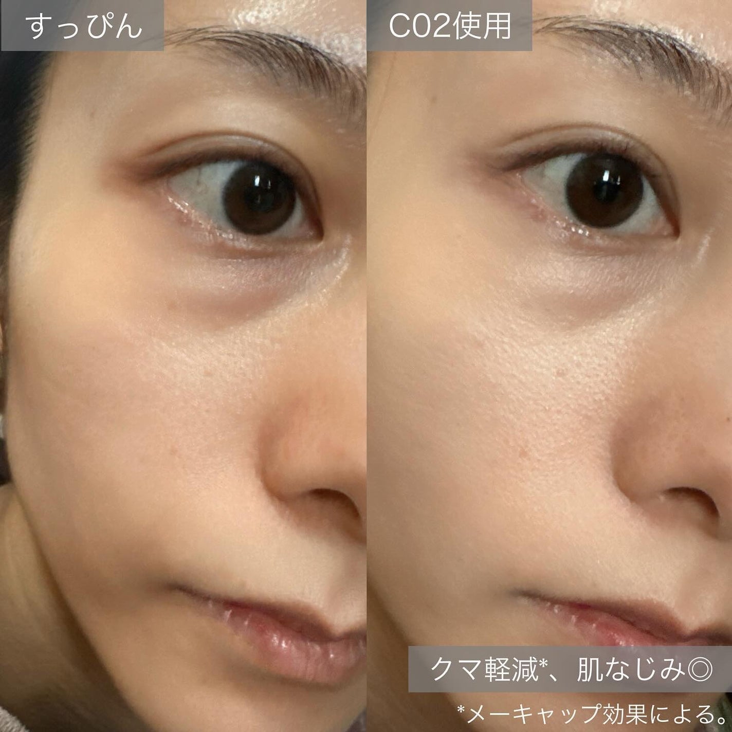 パーフェクトカバー コンシーラーパレット/Dear.A/パレットコンシーラーを使ったクチコミ(6枚目)