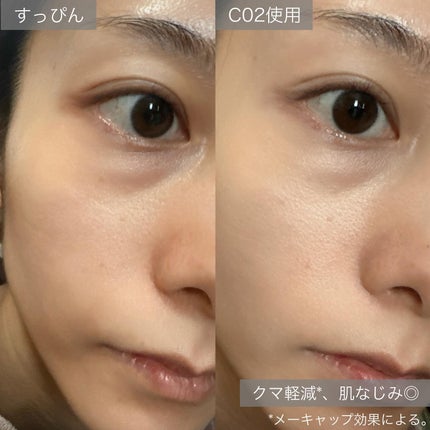 パーフェクトカバー コンシーラーパレット/Dear.A/パレットコンシーラーを使ったクチコミ(6枚目)