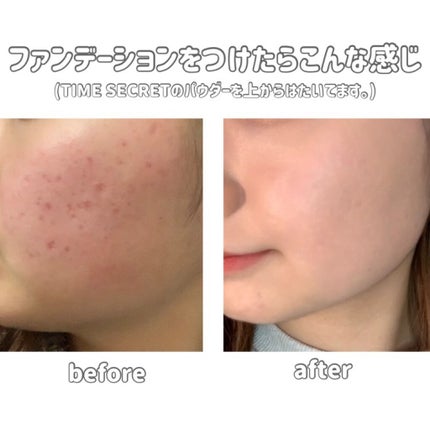 クリームファンデーションN/media/クリーム・エマルジョンファンデーションを使ったクチコミ(2枚目)