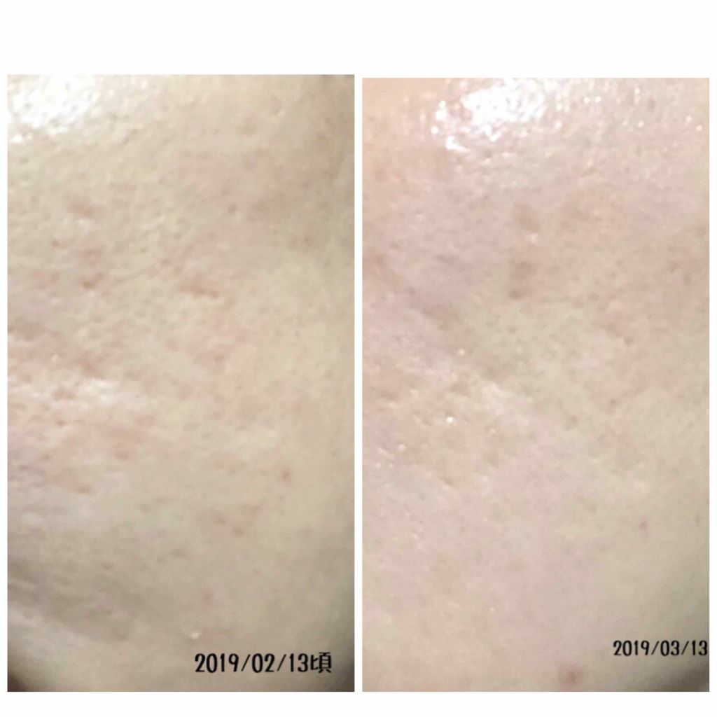 7 day Special Set プログラム3/b.glen/トライアルキットを使ったクチコミ(3枚目)