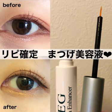 .
FEG  Eyelash  Enhancer

私のまつげは
・短い
・抜けやすい
・スカスカ

で、マスカラ塗っても存在感がない😅

何本かまつげ美容液を使って見たものの
抜けにくくなったりはした