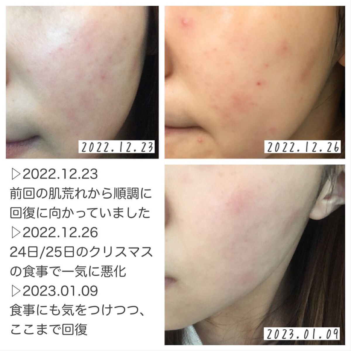 ハトムギ化粧水(ナチュリエ スキンコンディショナー R )/ナチュリエ/化粧水を使ったクチコミ（3枚目）