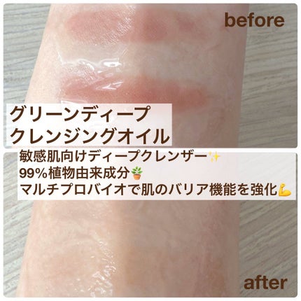 弱酸性クレンジングジェルフォーム/Dr.G/その他洗顔料を使ったクチコミ(3枚目)