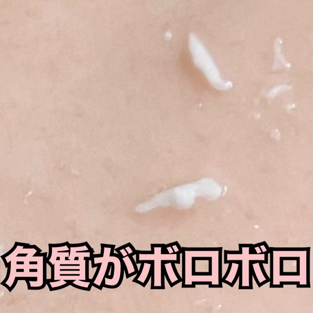 ハトムギエキスピーリングジェル/プラチナレーベル/ピーリングを使ったクチコミ（3枚目）