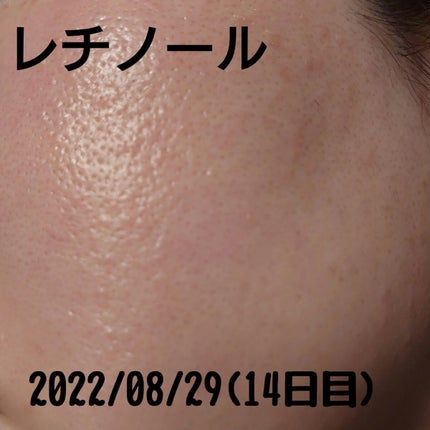 レチノールA 1% アドバンスドリバイタリゼーションクリーム/Life-flo/フェイスクリームを使ったクチコミ(2枚目)