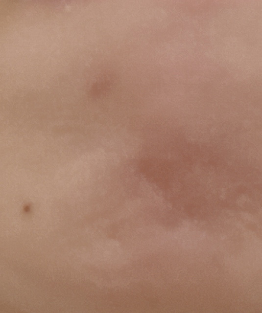 セルフホワイトニング ミッション/ALBION/美容液を使ったクチコミ（2枚目）