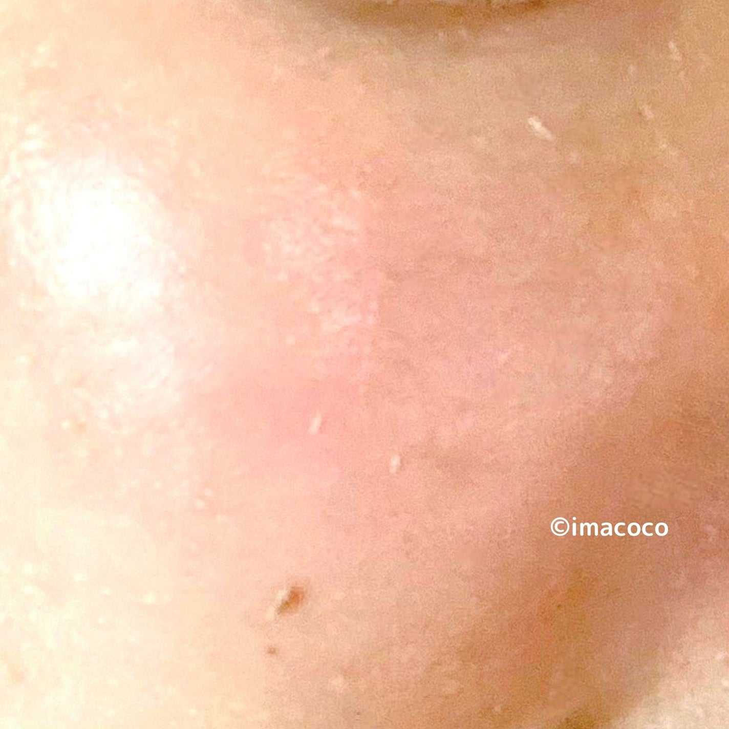 リアルシカペストパック/ビューランチ/洗い流すパック・マスクを使ったクチコミ(6枚目)