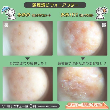 CICA デイリースージングマスク/VT/シートマスク・パックを使ったクチコミ(8枚目)