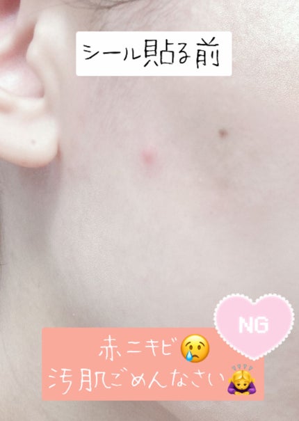 プロCICA クリアスポットパッチ/VT/その他スキンケアを使ったクチコミ(4枚目)